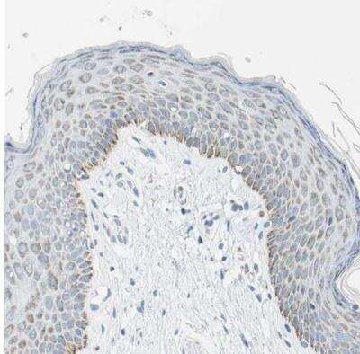 Immunohistochemistry-Paraffin: Cysteinyl Leukotriene R1/CysLTR1 Antibody [NBP1-85356]