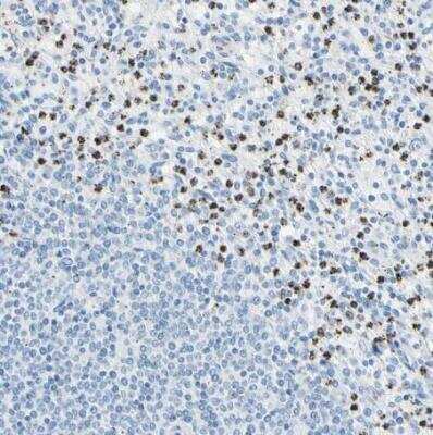 Immunohistochemistry-Paraffin: Cysteinyl Leukotriene R1/CysLTR1 Antibody [NBP1-85356]
