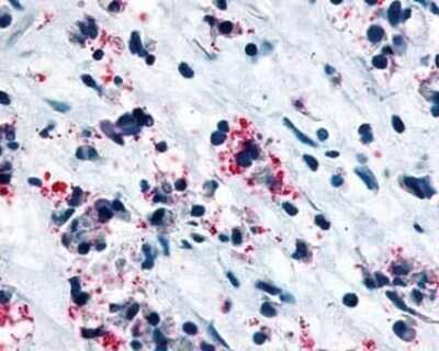 Immunohistochemistry-Paraffin: Cysteinyl Leukotriene R1/CysLTR1 Antibody - BSA Free [NLS1320]