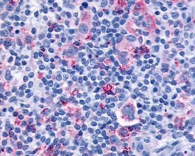 Immunohistochemistry-Paraffin: Cysteinyl Leukotriene R1/CysLTR1 Antibody - BSA Free [NLS1320]