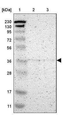 Western Blot: Cysteinyl Leukotriene R1/CysLTR1 Antibody [NBP1-85356]