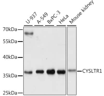 Western Blot: Cysteinyl Leukotriene R1/CysLTR1 AntibodyAzide and BSA Free [NBP2-92396]