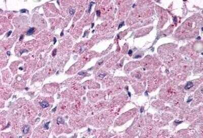 Immunohistochemistry-Paraffin: Cysteinyl Leukotriene R2/CysLTR2 Antibody - BSA Free [NBP1-02340]