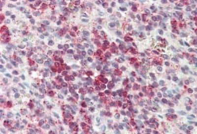 Immunohistochemistry-Paraffin: Cysteinyl Leukotriene R2/CysLTR2 Antibody [NBP3-14292]