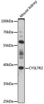 Western Blot: Cysteinyl Leukotriene R2/CysLTR2 AntibodyAzide and BSA Free [NBP2-92327]