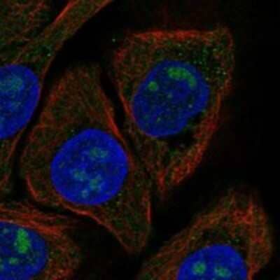 Immunocytochemistry/ Immunofluorescence: Cytochrome B, Ascorbate Dependent 3 Antibody [NBP3-17580]