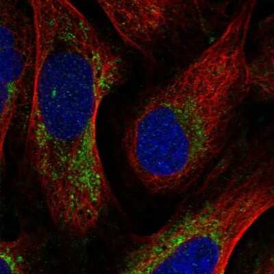 Immunocytochemistry/ Immunofluorescence: Cytochrome C Oxidase subunit 6c Antibody [NBP2-37857]