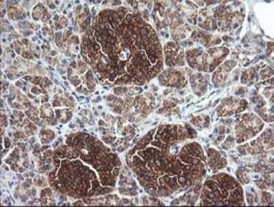 Immunohistochemistry: Cytochrome C Oxidase subunit 6c Antibody (OTI4B11) - Azide and BSA Free [NBP2-70430]