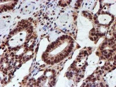 Immunohistochemistry-Paraffin: Cytochrome P450 17A1 Antibody (OTI3F11) [NBP2-01151]