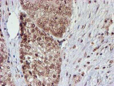 Immunohistochemistry-Paraffin: Cytochrome P450 17A1 Antibody (OTI3F11) [NBP2-01151]