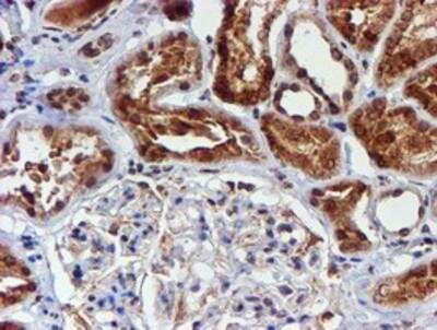 Immunohistochemistry-Paraffin: Cytochrome P450 17A1 Antibody (OTI3F11) [NBP2-01151]