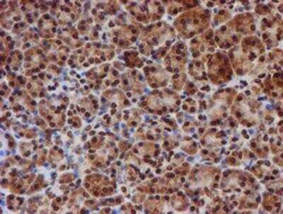 Immunohistochemistry-Paraffin: Cytochrome P450 17A1 Antibody (OTI3F11) [NBP2-01151]