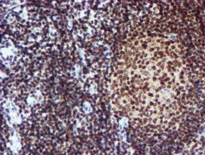 Immunohistochemistry-Paraffin: Cytochrome P450 17A1 Antibody (OTI3F11) [NBP2-01151]