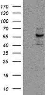 Western Blot: Cytochrome P450 17A1 Antibody (OTI3F11) [NBP2-01151]