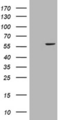 Western Blot: Cytochrome P450 17A1 Antibody (OTI3F12) [NBP2-46418]