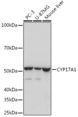 Western Blot: Cytochrome P450 17A1 Antibody (5D2H1) [NBP3-16541]