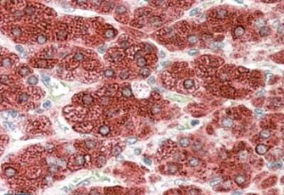 Immunohistochemistry-Paraffin: Cytochrome P450 17A1 Antibody [NB100-2842]