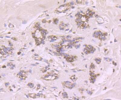 Immunohistochemistry-Paraffin: Cytochrome P450 17A1 Antibody (JB93-32) [NBP2-75461]