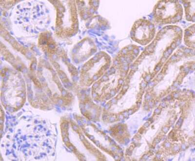 Immunohistochemistry-Paraffin: Cytochrome P450 17A1 Antibody (JB93-32) [NBP2-75461]