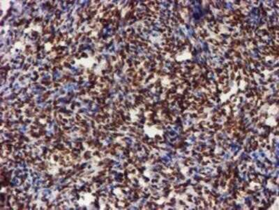 Flow Cytometry: Cytochrome P450 17A1 Antibody (OTI3F11) - Azide and BSA Free [NBP2-70544]