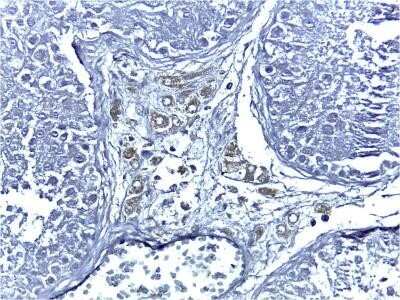 Immunohistochemistry: Cytochrome P450 17A1 Antibody (OTI3F11) - Azide and BSA Free [NBP2-70544]