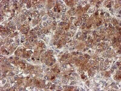 Immunohistochemistry: Cytochrome P450 17A1 Antibody (OTI3F11) - Azide and BSA Free [NBP2-70544]