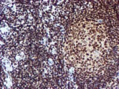 Immunohistochemistry: Cytochrome P450 17A1 Antibody (OTI3F11) - Azide and BSA Free [NBP2-70544]