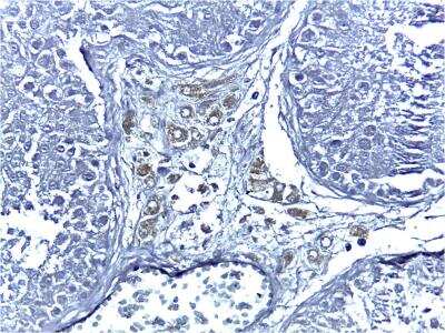 Immunohistochemistry: Cytochrome P450 17A1 Antibody (OTI3F11) [NBP2-01151]