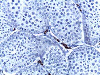 Immunohistochemistry: Cytochrome P450 17A1 Antibody (OTI3F11) [NBP2-01151]