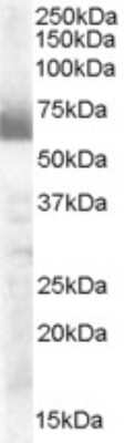 Western Blot: Cytochrome P450 17A1 Antibody [NB100-2842]