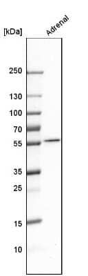 Western Blot: Cytochrome P450 17A1 Antibody [NBP2-13892]