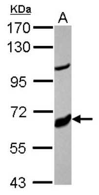 Western Blot: Cytochrome P450 17A1 Antibody [NBP2-16077]