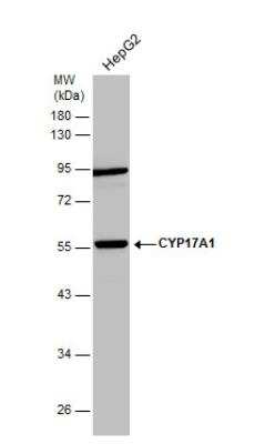 Western Blot: Cytochrome P450 17A1 Antibody [NBP2-16077]