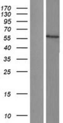 Western Blot: Cytochrome P450 17A1 Overexpression Lysate [NBL1-09673]