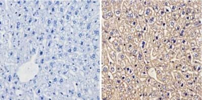 Immunohistochemistry-Paraffin: Cytochrome P450 1A1/1A2 Antibody (MC1) [NB100-74398]