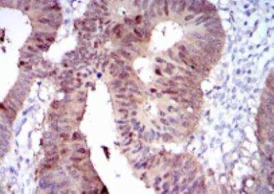 Immunohistochemistry-Paraffin: Cytochrome P450 1A1 Antibody (6G5) - BSA Free [NBP2-37526]