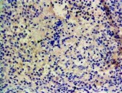 Immunohistochemistry-Paraffin: Cytochrome P450 1A1 Antibody [NBP1-97762]
