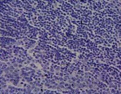 Immunohistochemistry-Paraffin: Cytochrome P450 1A1 Antibody [NBP1-97762]