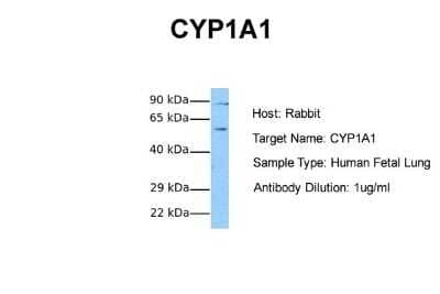 Western Blot: Cytochrome P450 1A1 Antibody [NBP1-62405]