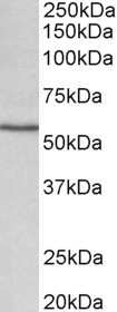 Western Blot: Cytochrome P450 1A1 Antibody [NBP1-97762]
