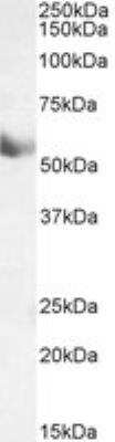 Western Blot: Cytochrome P450 1A1 Antibody [NBP1-97762]