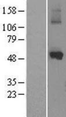 Western Blot: Cytochrome P450 1A1 Overexpression Lysate [NBL1-09675]