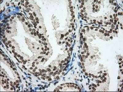 Immunohistochemistry: Cytochrome P450 1A2 Antibody (OTI8F1) - Azide and BSA Free [NBP2-70518]