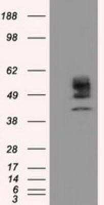 Western Blot: Cytochrome P450 1A2 Antibody (OTI8F1)Azide and BSA Free [NBP2-70518]