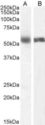 Western Blot: Cytochrome P450 1A2 Antibody [NBP1-97780]