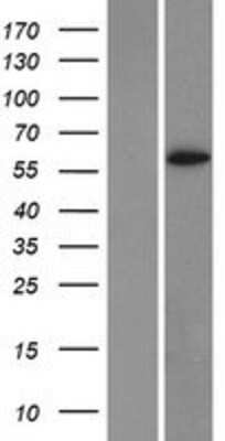 Western Blot: Cytochrome P450 1A2 Overexpression Lysate [NBP2-10707]