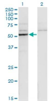 Western Blot: Cytochrome P450 26B1 Antibody (1H6) [H00056603-M01]