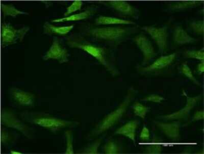 Immunocytochemistry/ Immunofluorescence: Cytochrome P450 26B1 Antibody (2G7) [H00056603-M02]