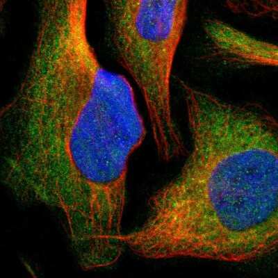 Immunocytochemistry/ Immunofluorescence: Cytochrome P450 26B1 Antibody [NBP1-87371]