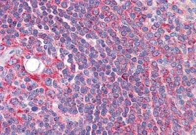 Immunohistochemistry-Paraffin: Cytochrome P450 26B1 Antibody [NB100-53810]